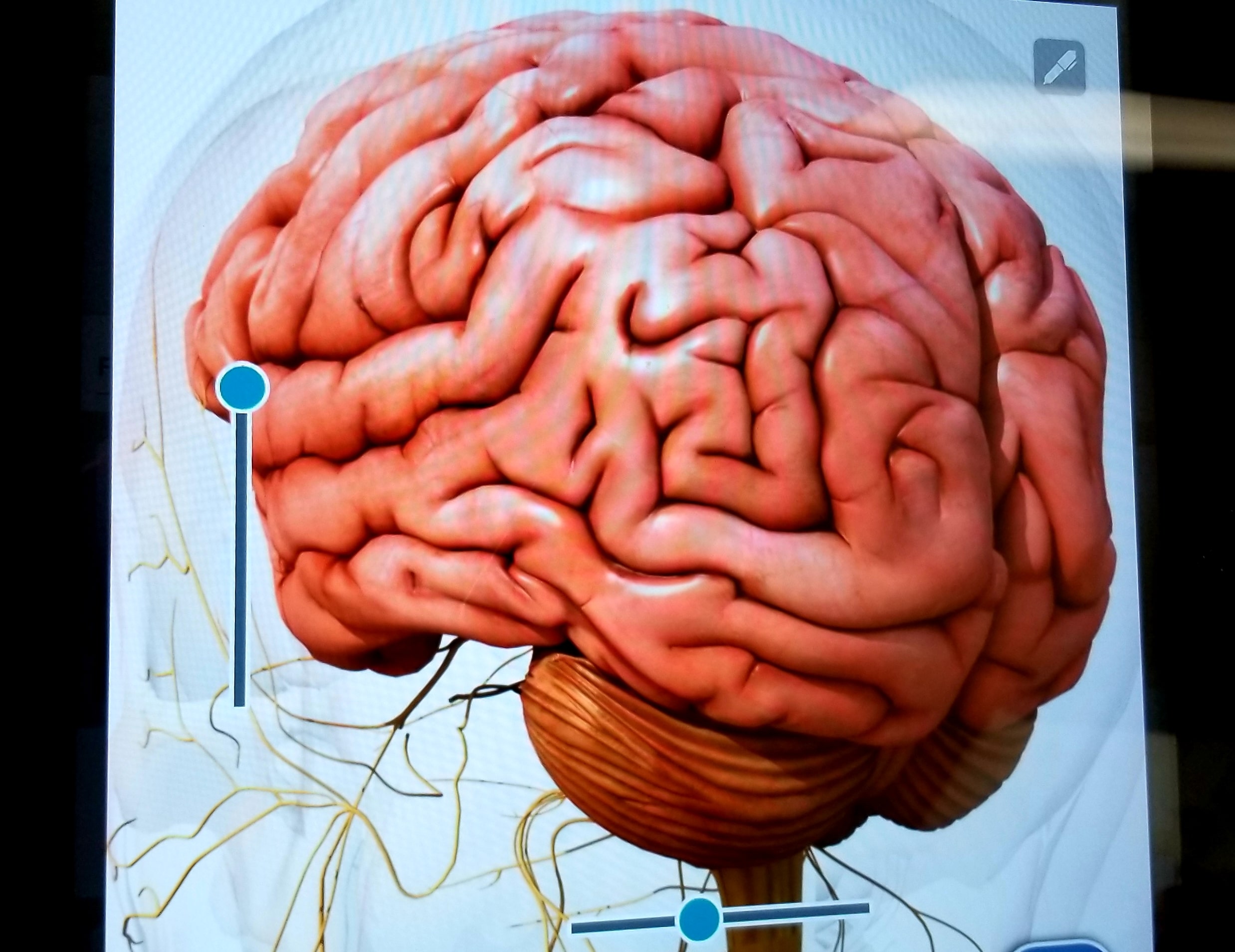 human brain digital image epilepsy awareness ne 2022 11 08 03 14 40 utc