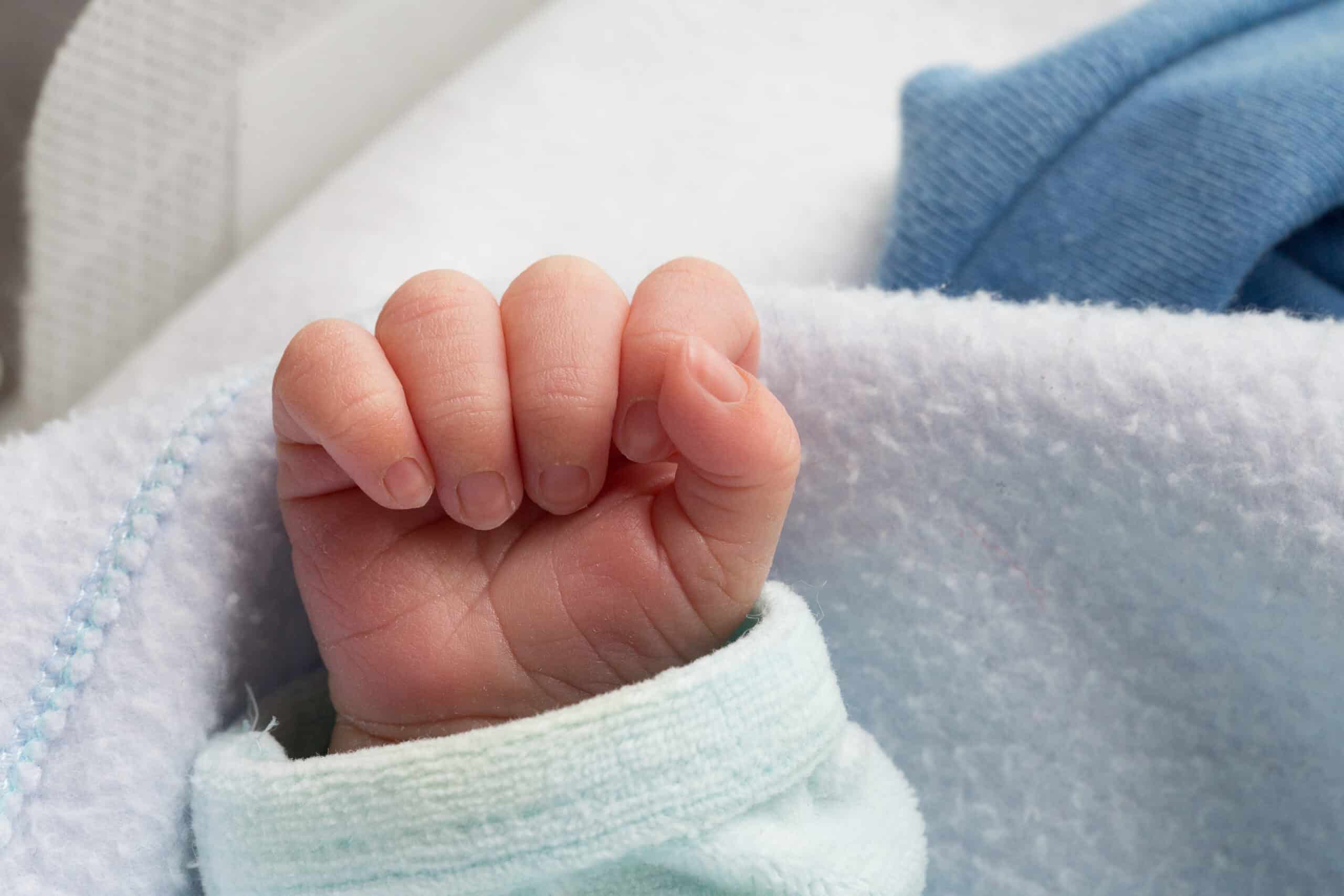 little hand of premature baby 2023 08 17 14 29 02 utc scaled