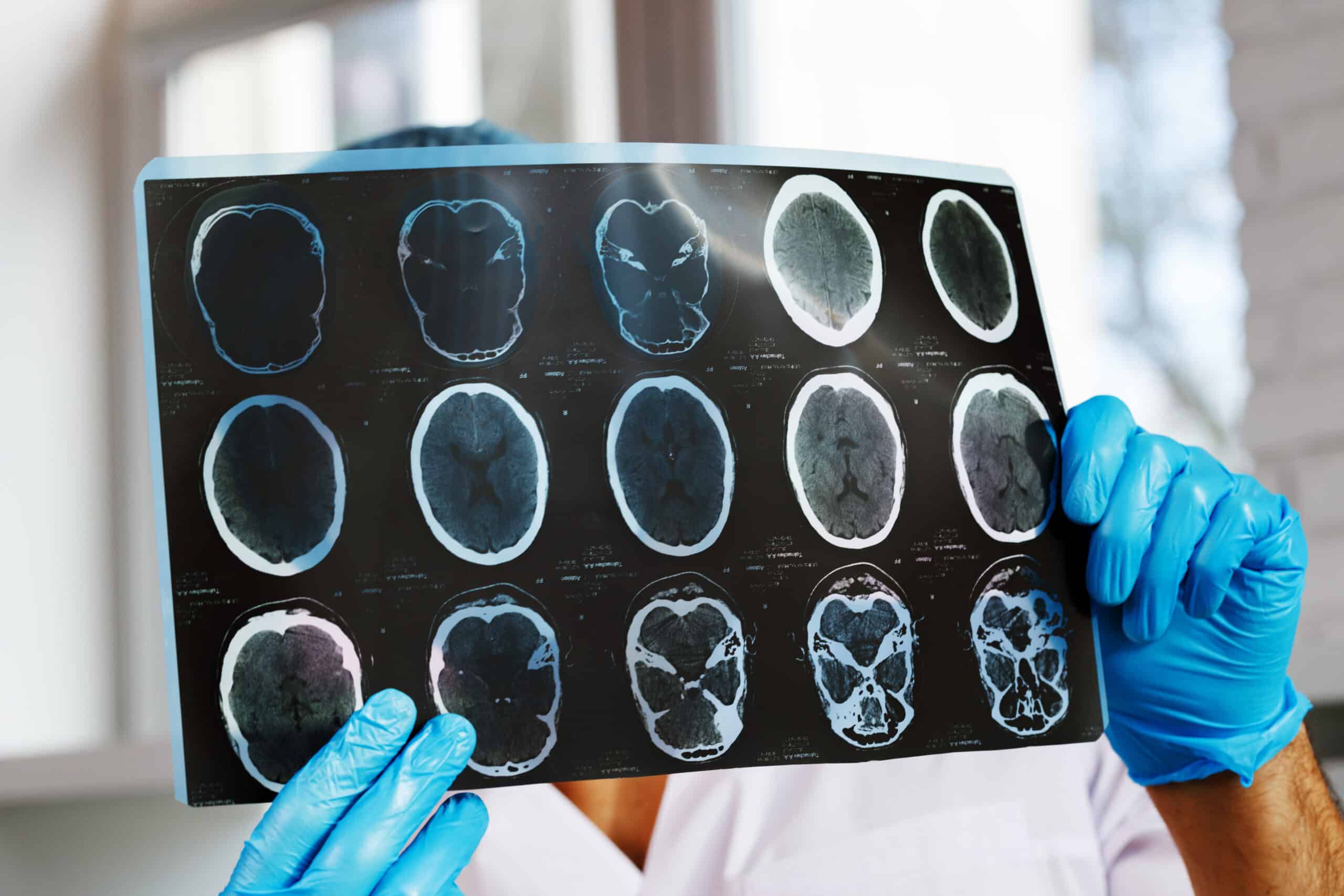 male doctor examines mri brain scan of a patient 2021 09 03 14 39 36 utc scaled