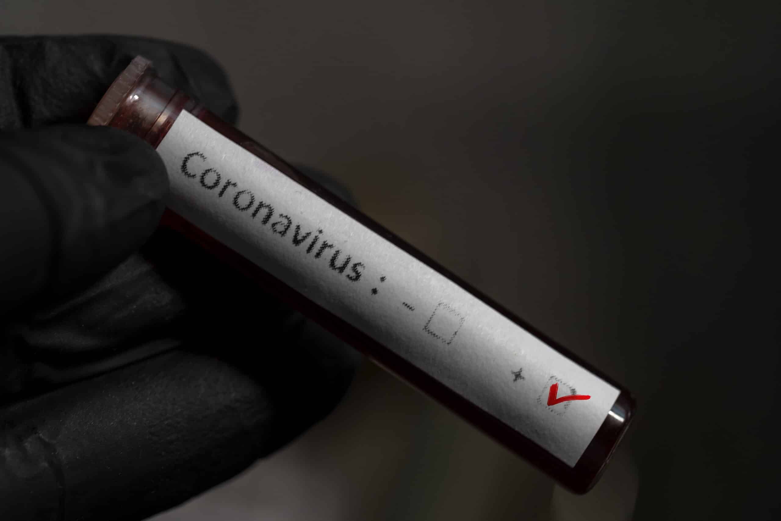Positive test for coronavirus