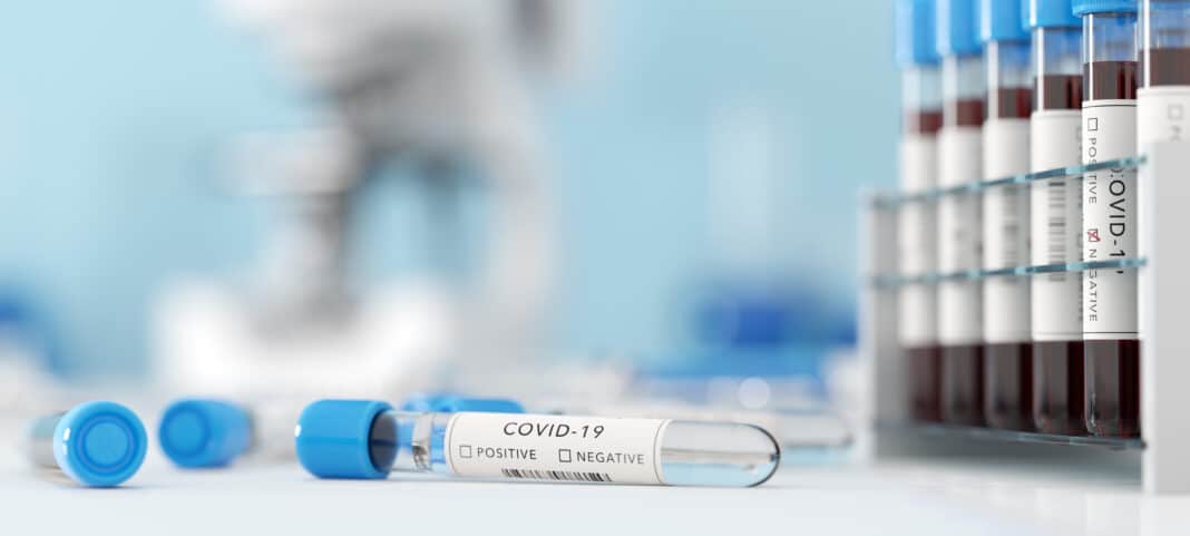 Testing for coronavirus Covid-19 in a lab. Covid medical screening